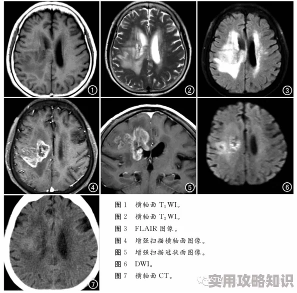 男人叼女人的痛爽视频免费：最新动态揭示了更多刺激与挑战，带你体验前所未有的感官盛宴！