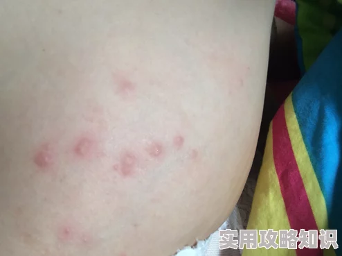 老师说下面痒让我揉一下校医检查后发现是蚊子叮咬已做简单处理